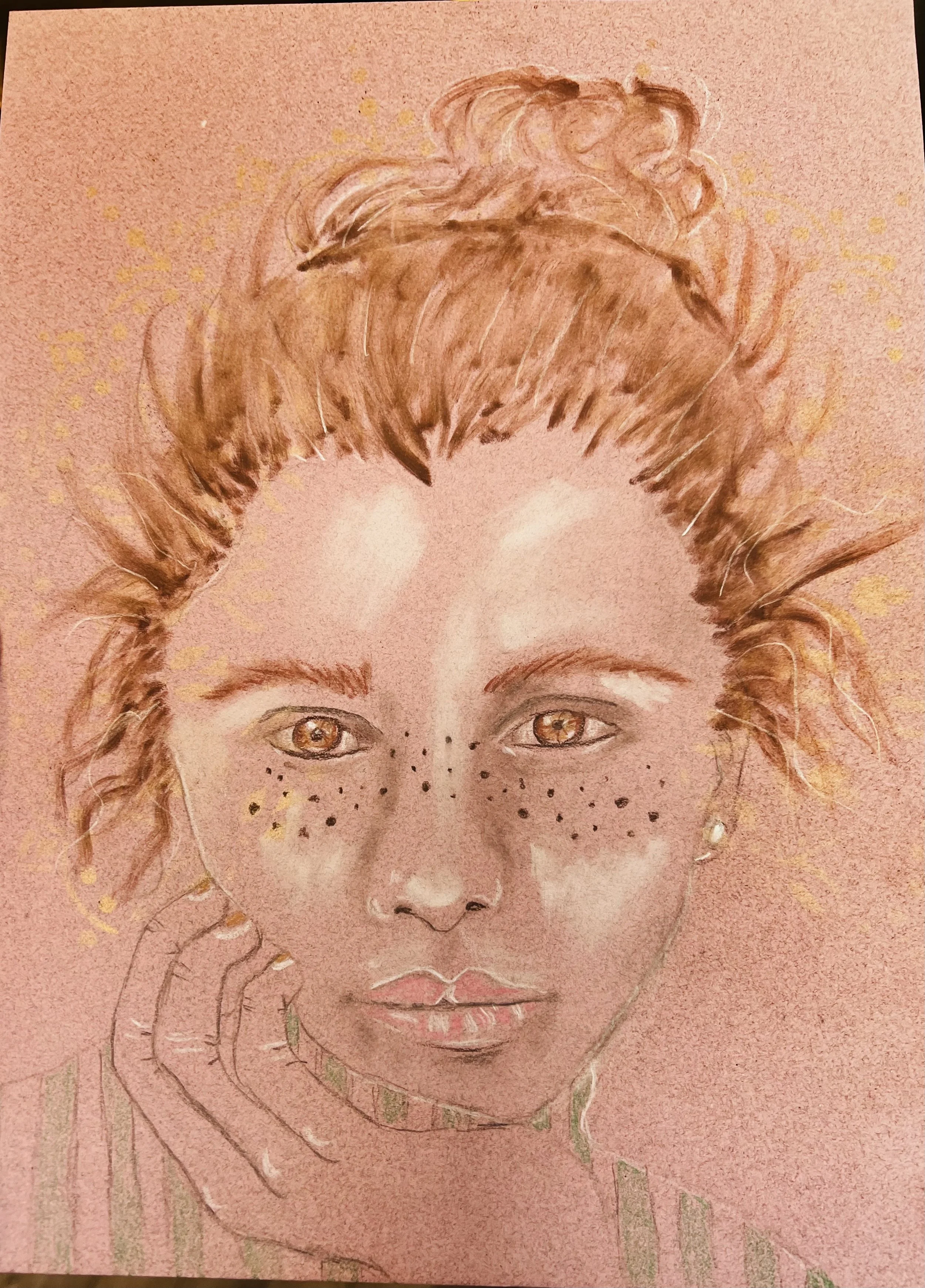 Freckle Face