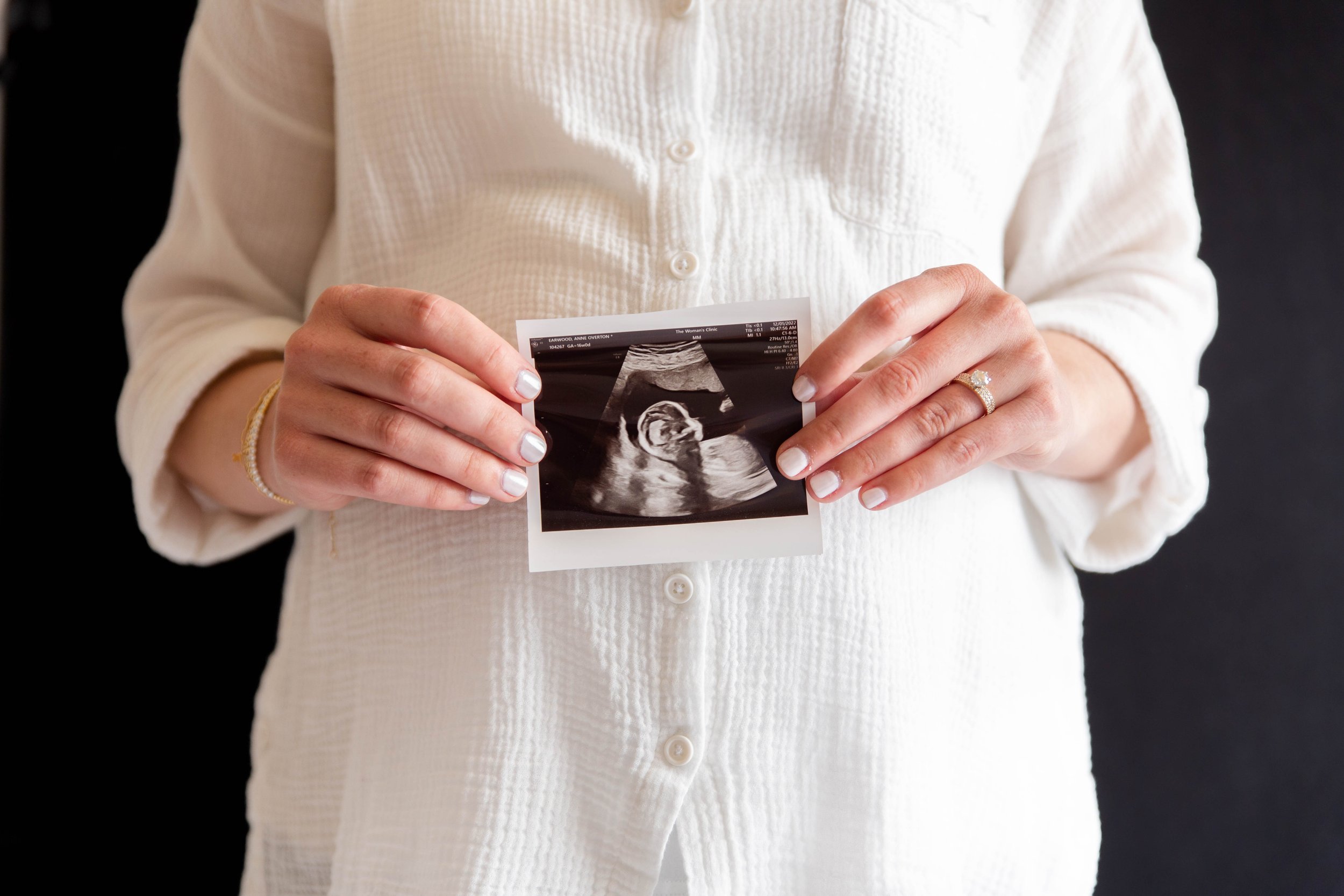 AnneOverton_Maternity_March2023-109.jpg