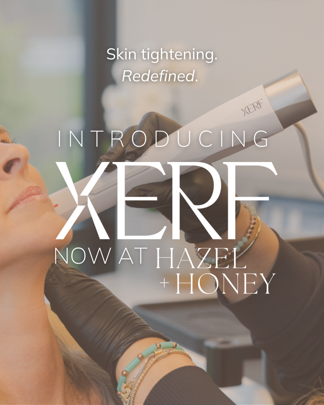 XERF Skin Tightening in Wichita: Lift and Firm Without Surgery, Needles, or Downtime