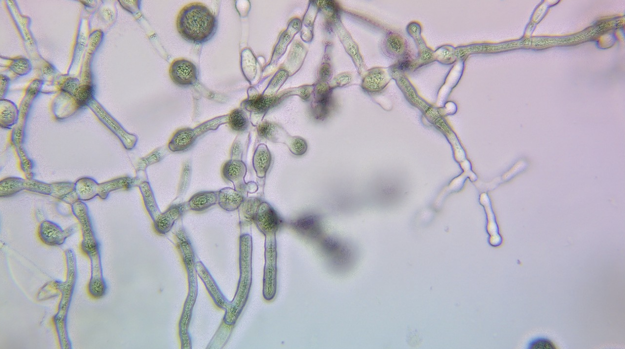 Swiss Army Knives & Finding Meaning in Fungal Physicality