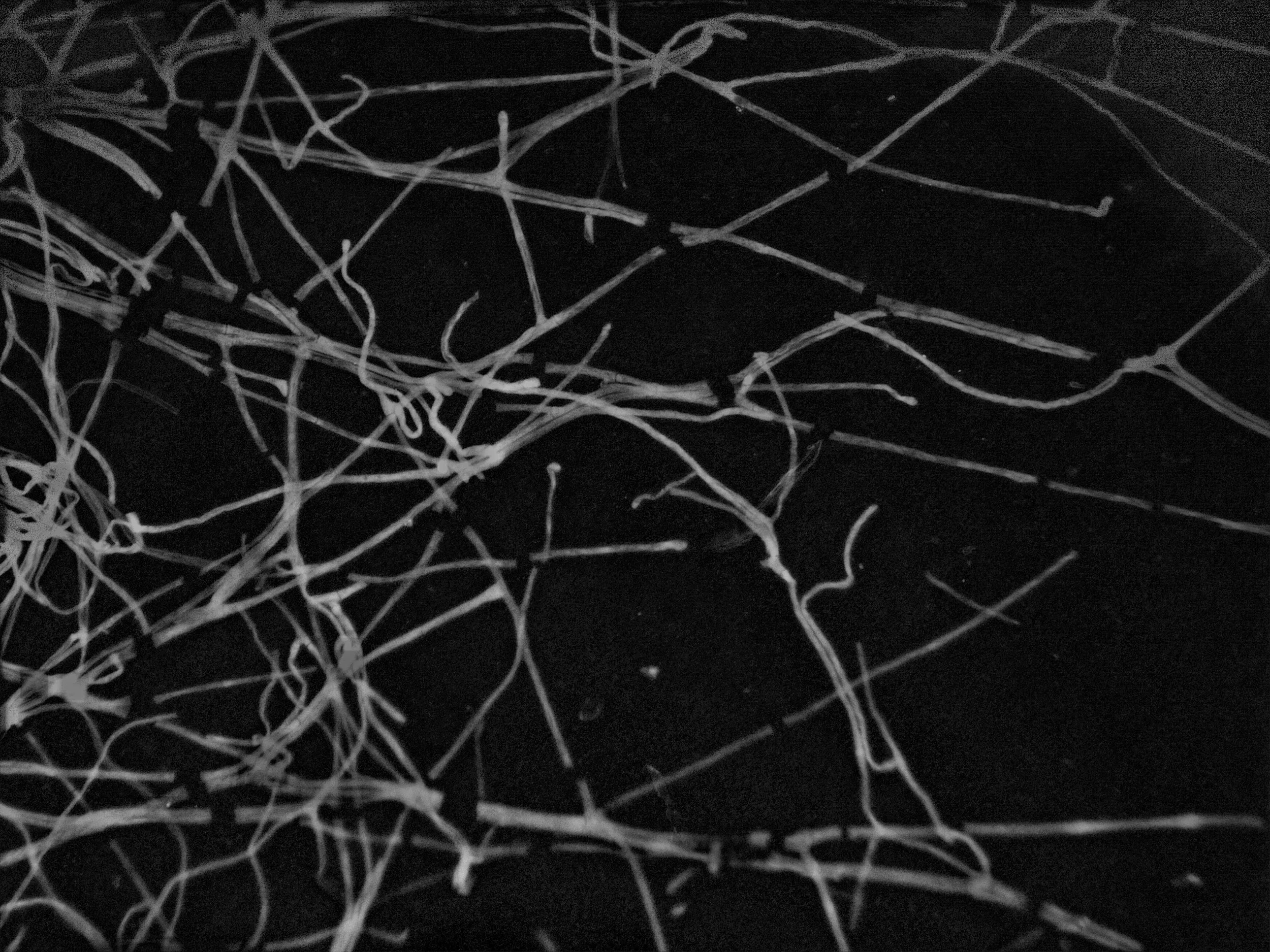 Mycelium as Structural Memory (And The Dichotomy of Mycelial Toughness)