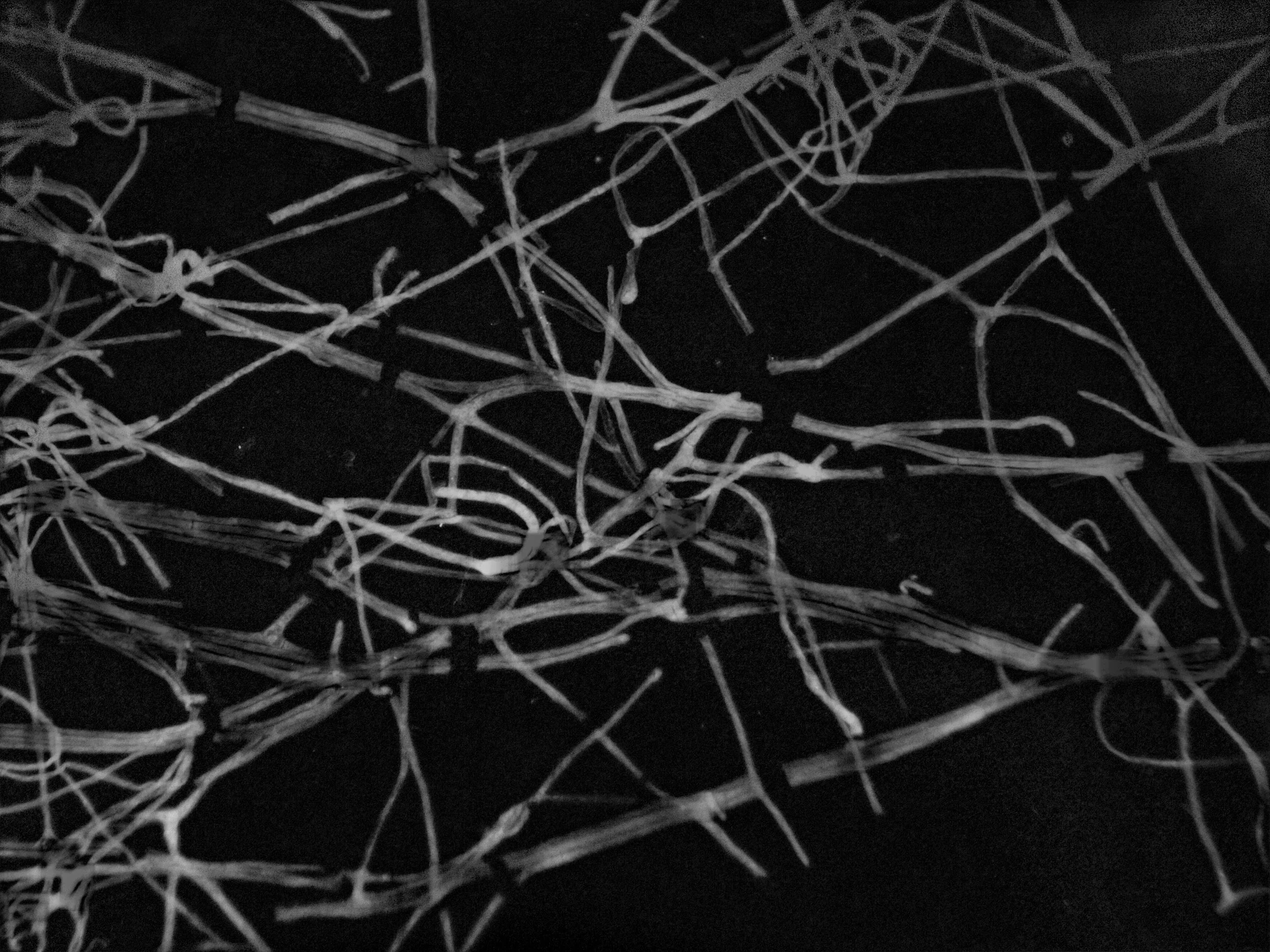 Mycelium Is the Message