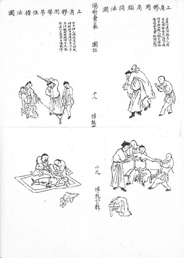 A series of traditional Chinese illustrations demonstrating various medical or therapy procedures with accompanying Chinese text.