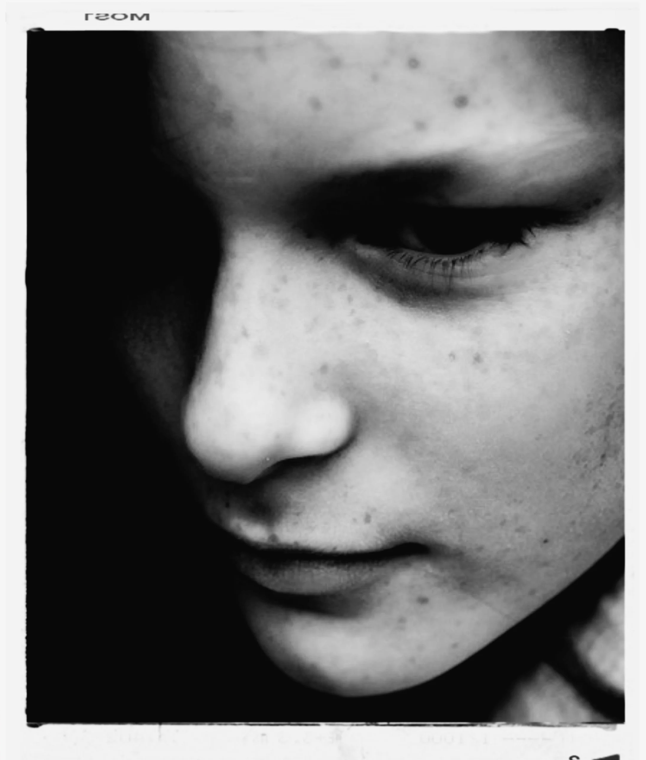 Close-up black and white photo of a young person's face with freckles, showing only part of the face, looking down with a contemplative expression.