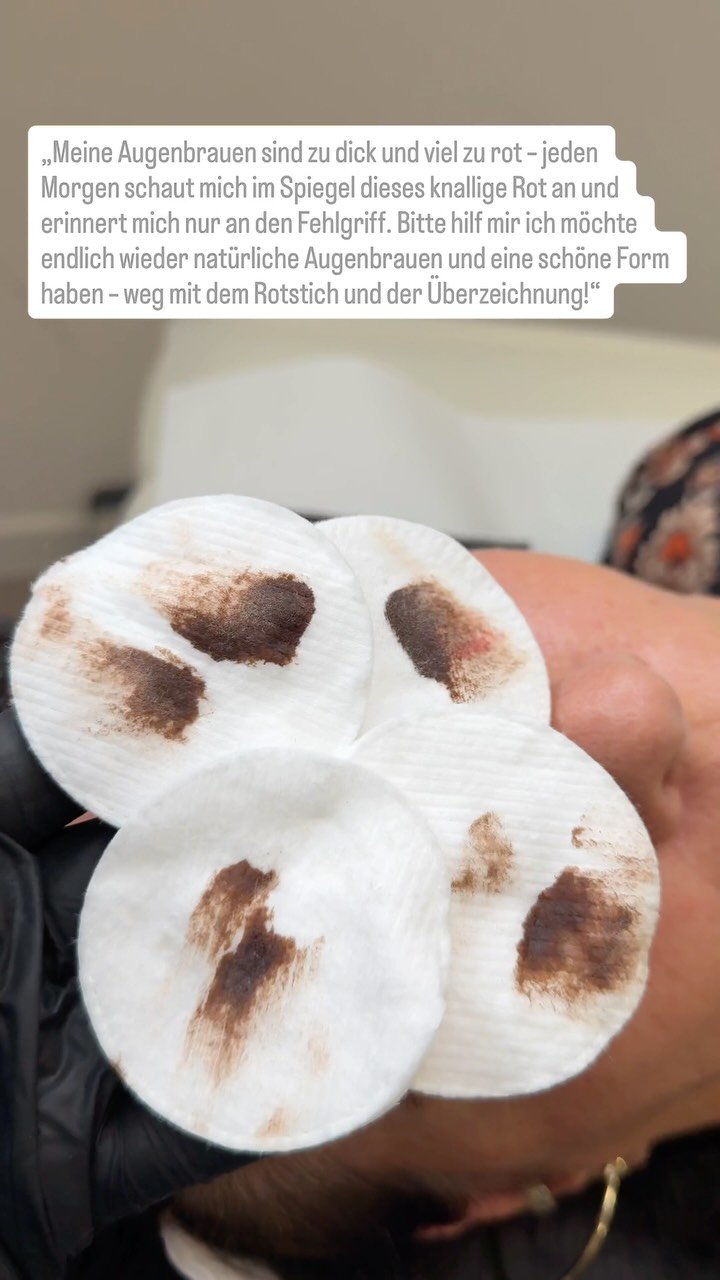 Sanfte PMU-Entfernung – Ohne Laser. Ohne Säure. Ohne Kompromisse. ✨
Du hast genug von alten, verblassten oder unsauber gestochenen Permanent Make-up Linien? Schluss mit unerwünschtem Look!
Unsere innovative PMU-Entfernungsmethode e