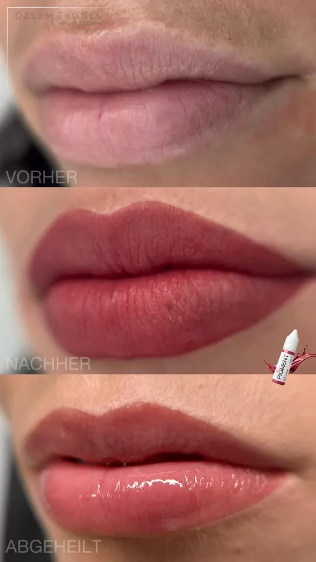 ✨ Abgeheiltes Lippen-Ergebnis ✨
Meine Kundin kam mit sehr blassen Naturlippen und wünschte sich ein natürliches Ergebnis – mit etwas mehr Farbe und frischer Kontur. 💋
Viele haben anfangs Angst, dass die Lippen nach der Behandlung z