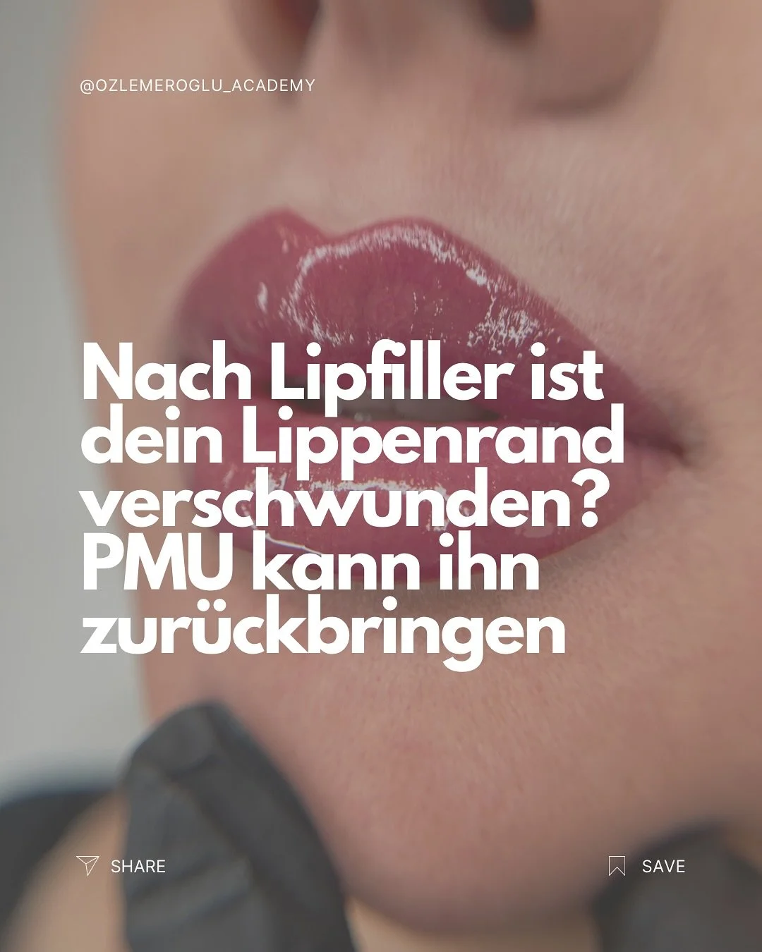 Viele meiner Kundinnen kommen nach einer Hyaluronbehandlung zu mir und sagen:
👉 „Mein Lippenrand ist verschwunden.“
👉 „Meine Lippen wirken plötzlich asymmetrisch.“
👉 „Die Farbe ist fahl geworden – irgend