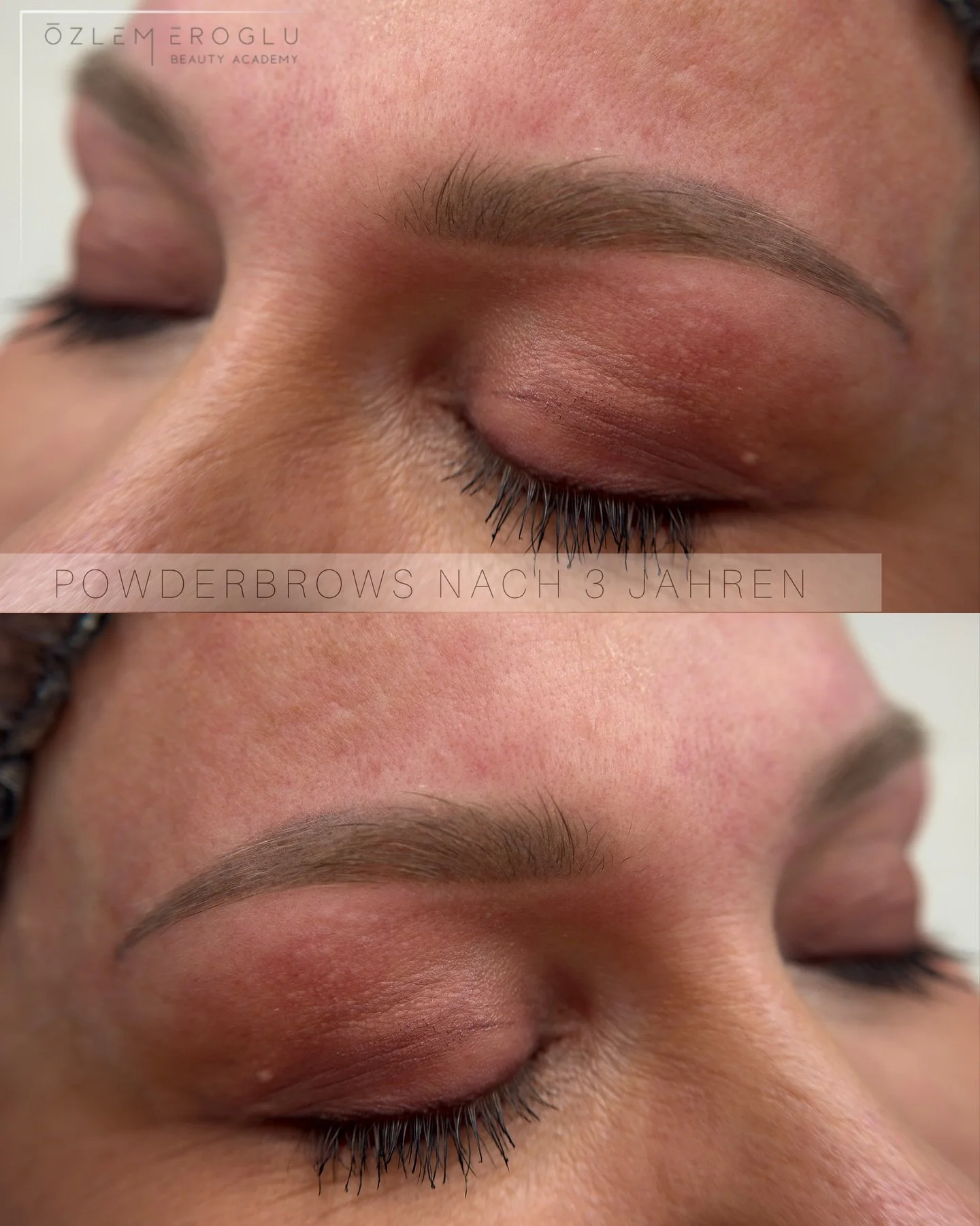 ✨ Instagram Caption &ndash; 3 Jahre alte PowderBrows

3 Jahre alt &ndash; und immer noch so sch&ouml;n soft ✨
Das ist der Unterschied, wenn PowderBrows richtig typgerecht, sanft und mit hochwertiger Technik gearbeitet werden.

Meine Kundin tr&auml;gt