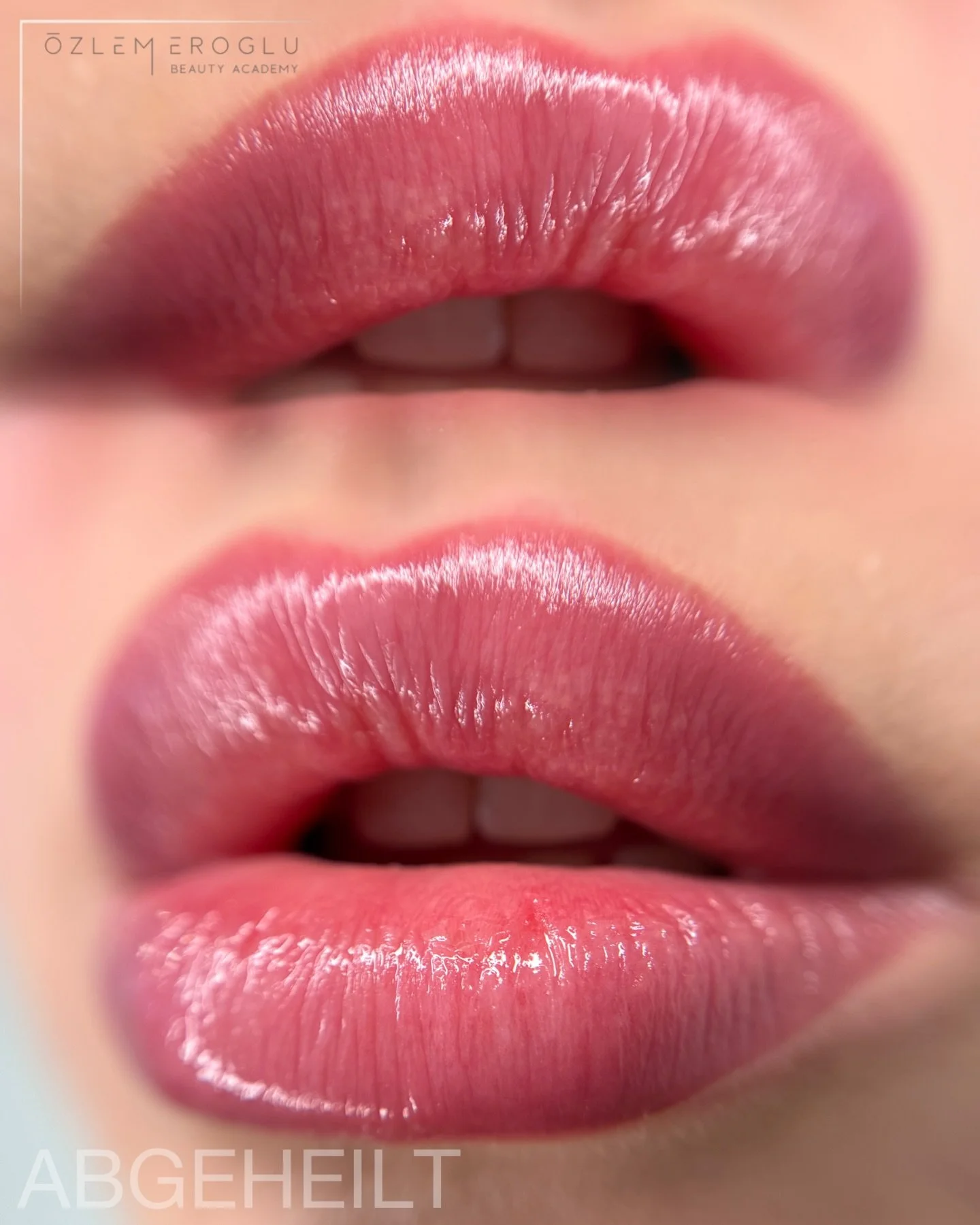 💋 Abgeheilt &ndash; dezent gemacht &amp; richtig frisch
Ja, man sieht, dass hier nachgeholfen wurde 🙂

Aber genau so lieben wir es: weich, nat&uuml;rlich und gepflegt, kein harter Rand, keine dominante Farbe ✨

Ein bisschen Lipgloss drauf &ndash; u