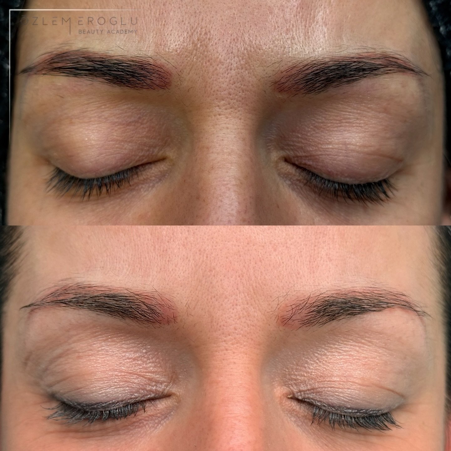 Dieses Ergebnis m&ouml;chte ich euch unbedingt zeigen 🤍

Auf dieser Collage seht ihr ein altes, stark r&ouml;tliches Permanent Make-up &ndash; und das Ergebnis nach zwei schonenden Removal-Behandlungen.

Solche Rotstiche entstehen mit der Zeit, wenn