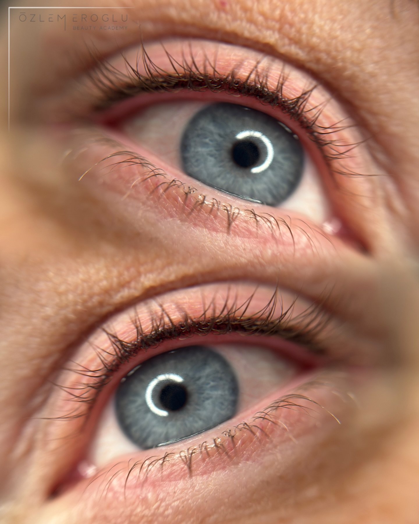 Mehr Ausdruck &ndash; ganz ohne Mascara ✨

Die Wimpernkranzverdichtung ist perfekt f&uuml;r alle, die sich einen nat&uuml;rlich intensiveren Blick w&uuml;nschen, ohne geschminkt auszusehen 🤍

Dabei wird der feine Wimpernansatz sanft pigmentiert &nda