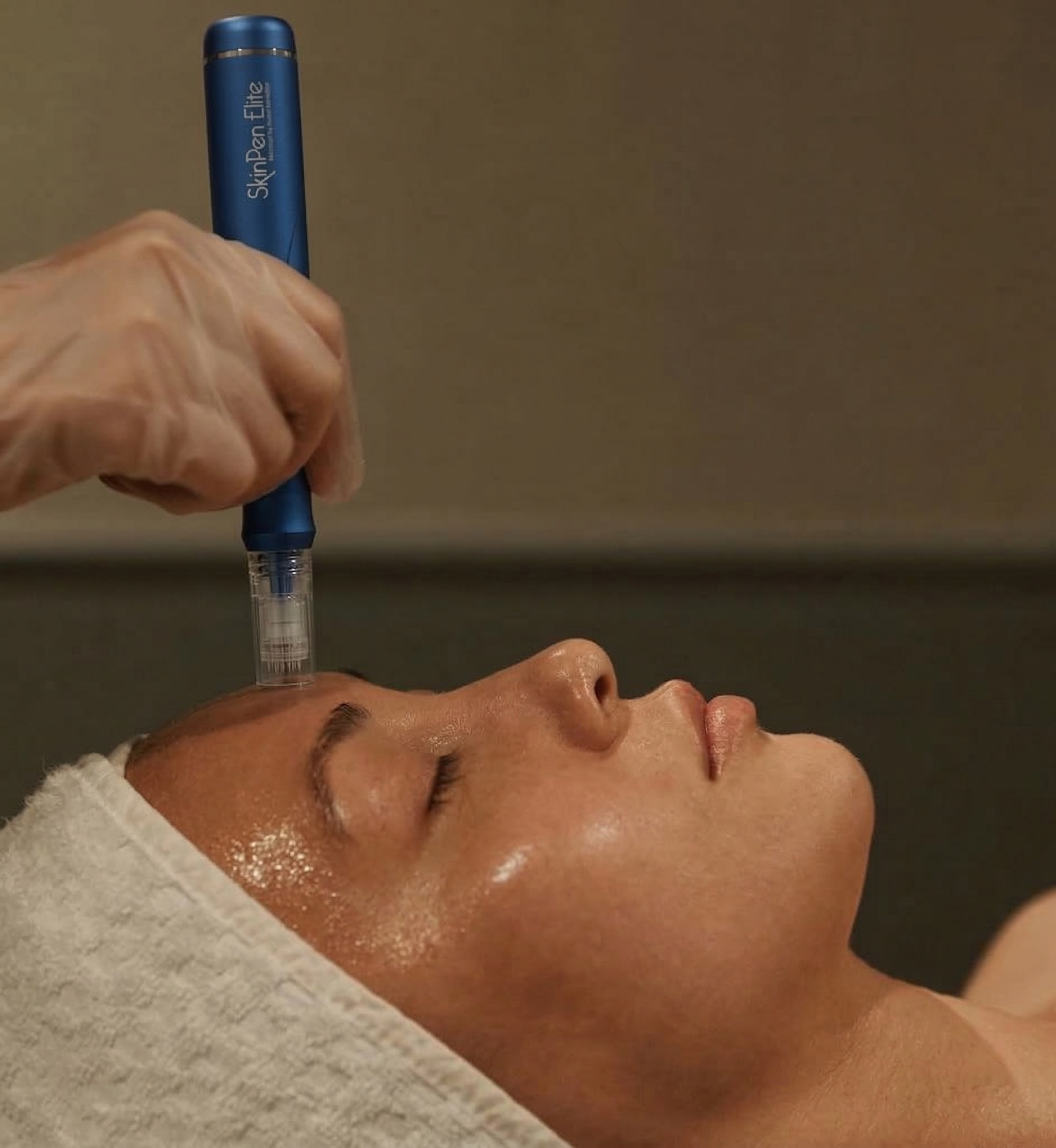 Someone receiving a facial treatment while lying down with eyes closed, with a starpen device held close to the forehead by a hand wearing a glove.