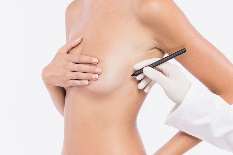 Breast Lift Surgery & Recovery