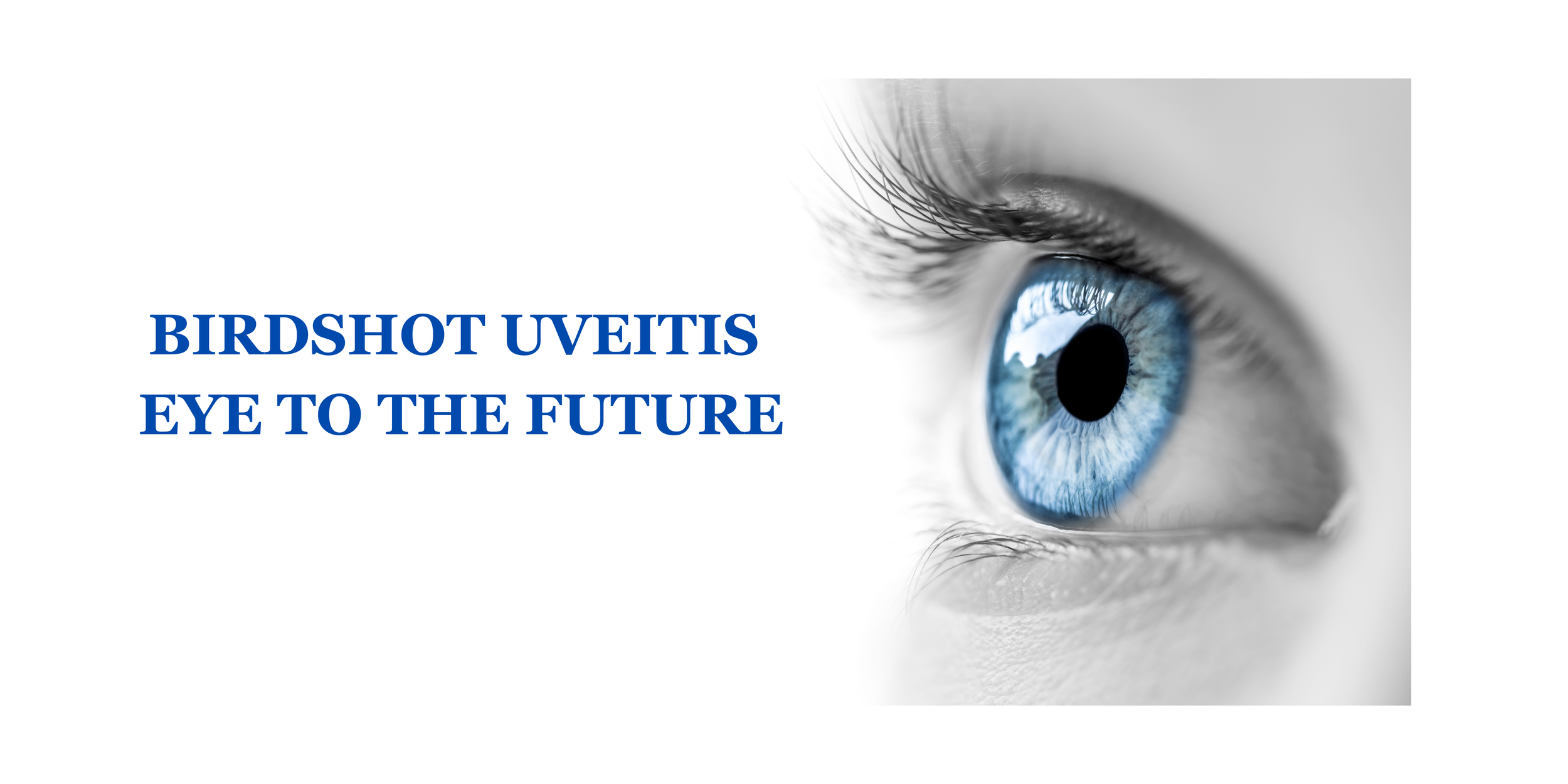 Update from Dr. Jennifer E. Thorne on AI Birdshot research