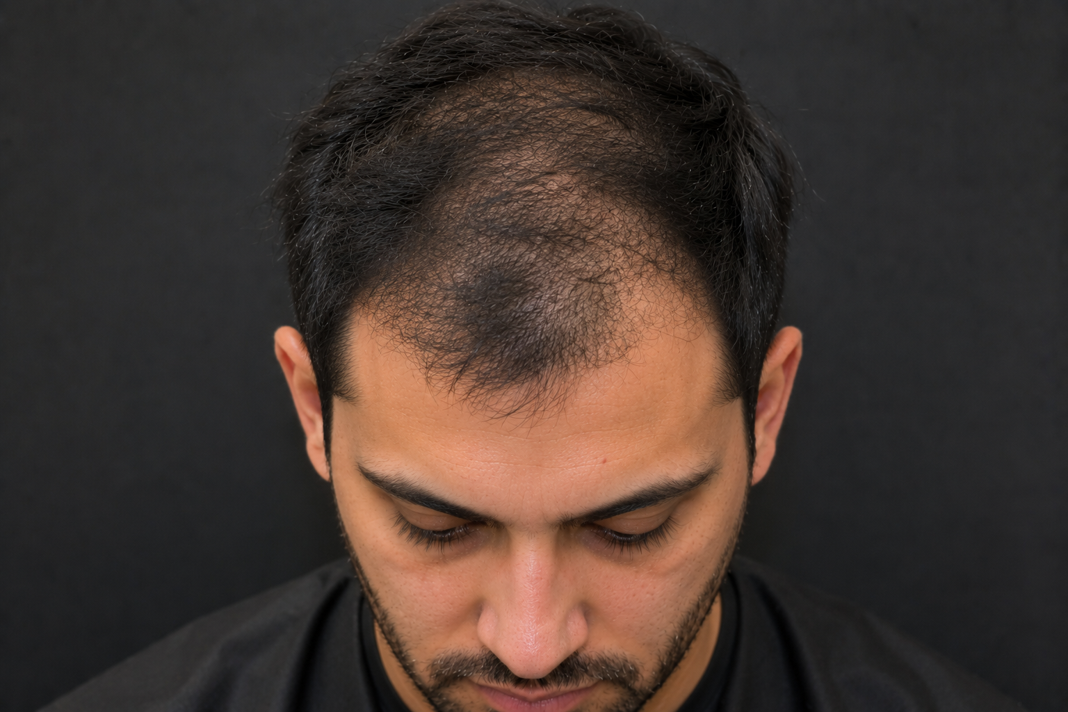"My Scalp Is Constantly Itchy and My Hair Is Thinning. Could This Be Early Male Pattern Baldness?"