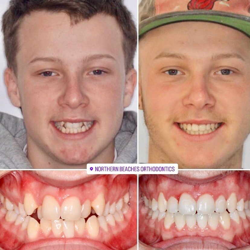 Contact Northern Beaches Orthodontists Dee Why & Mona Vale Orthodontists