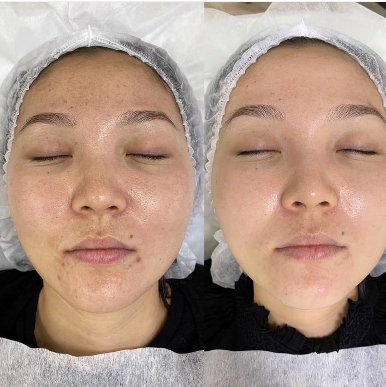 YELLOW PEELING (RETINOL) — Way of Beauty
