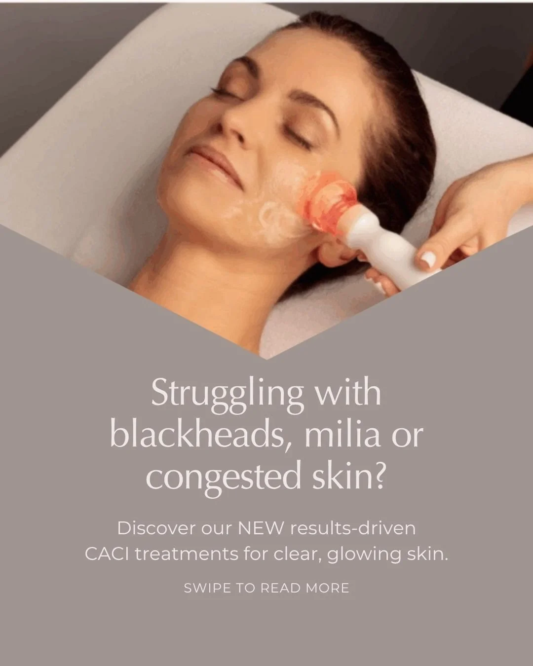 ✨ Clear, Smooth, Confident Skin Starts Here ✨

Struggling with blackheads, milia or congestion?

Our NEW CACI facial deeply cleanses, purifies and refines your skin &mdash; leaving it calm, clear and glowing.
💧 Oxy Cleansing Pod to purify
⚡ CACI Orb