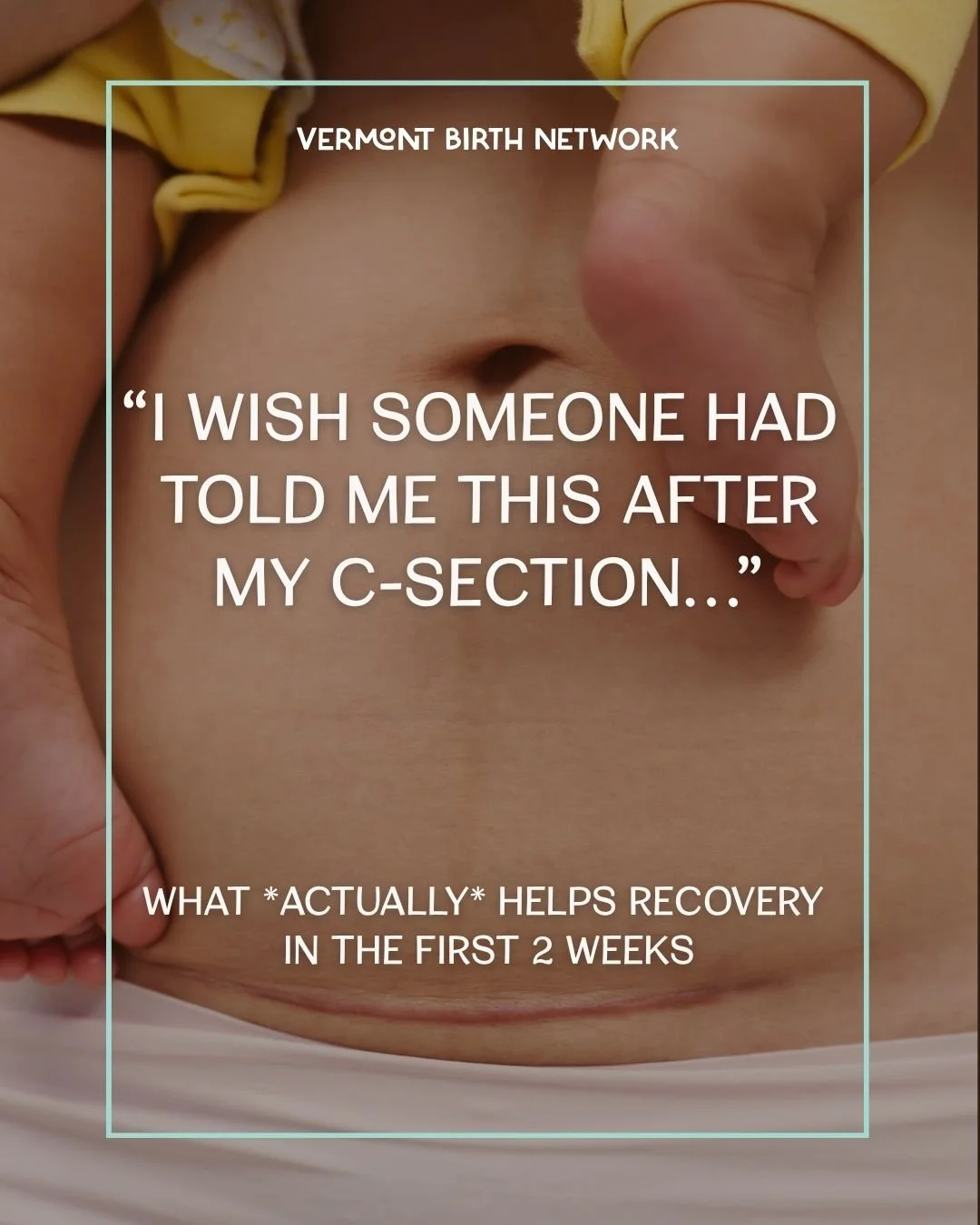 The first two weeks after a C-section can feel intense physically and emotionally.

It&rsquo;s surgery, postpartum recovery, and newborn care&hellip; all at once.

We gathered insights from Vermont providers on what to expect, what really helps, and 
