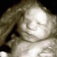 baby2.jpg