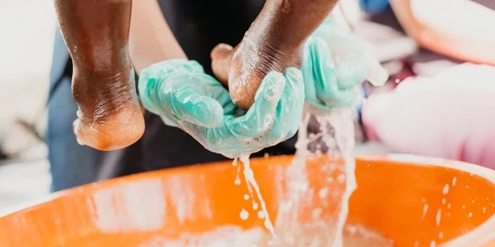 Sole Hope clinic staff gently washing a patient's feet during jigger treatment in Uganda