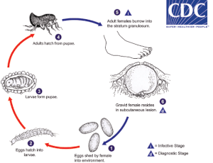What Are Jiggers? Understanding Tunga Penetrans & How Sole Hope Is ...