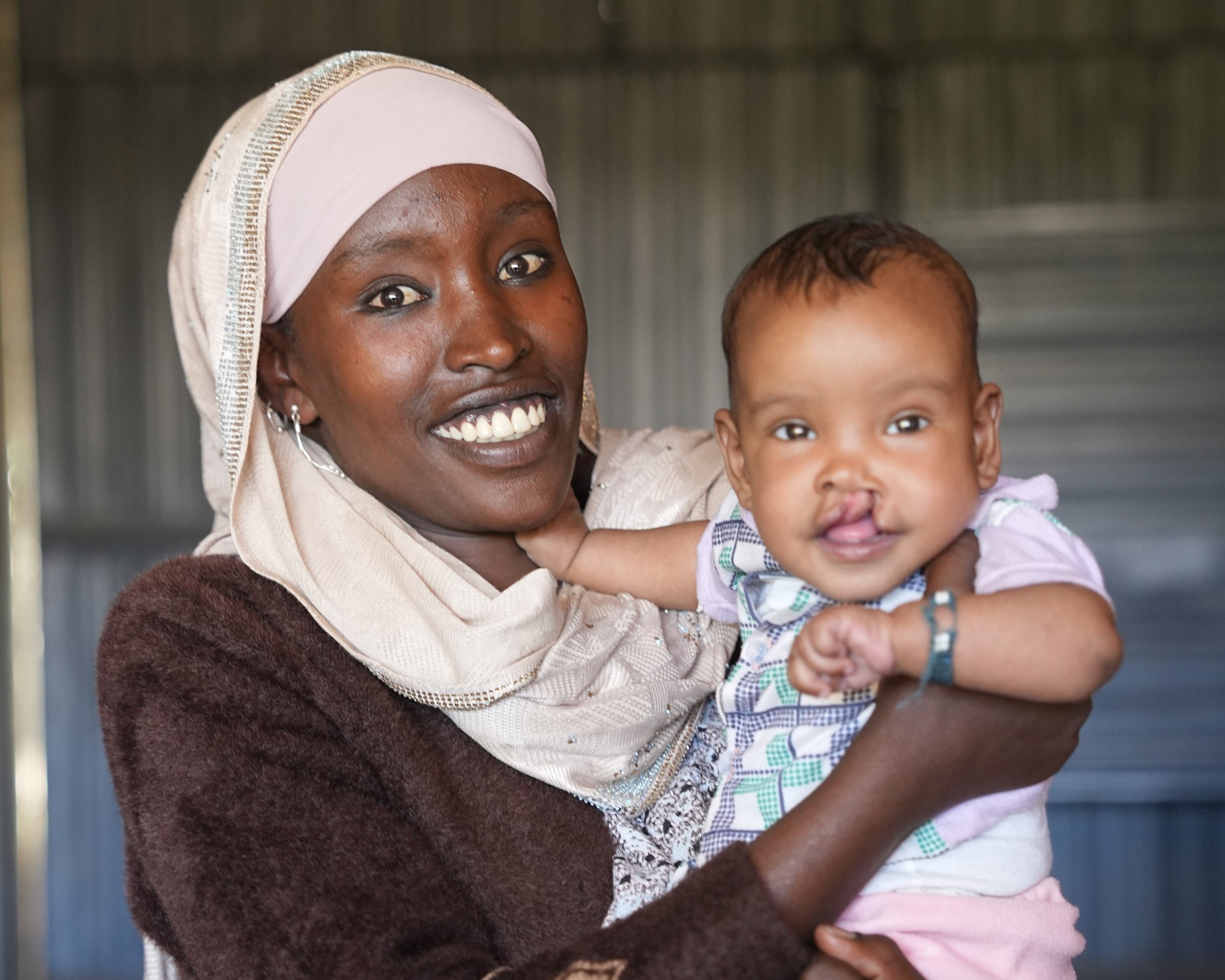 Akilima before receiving surgery.