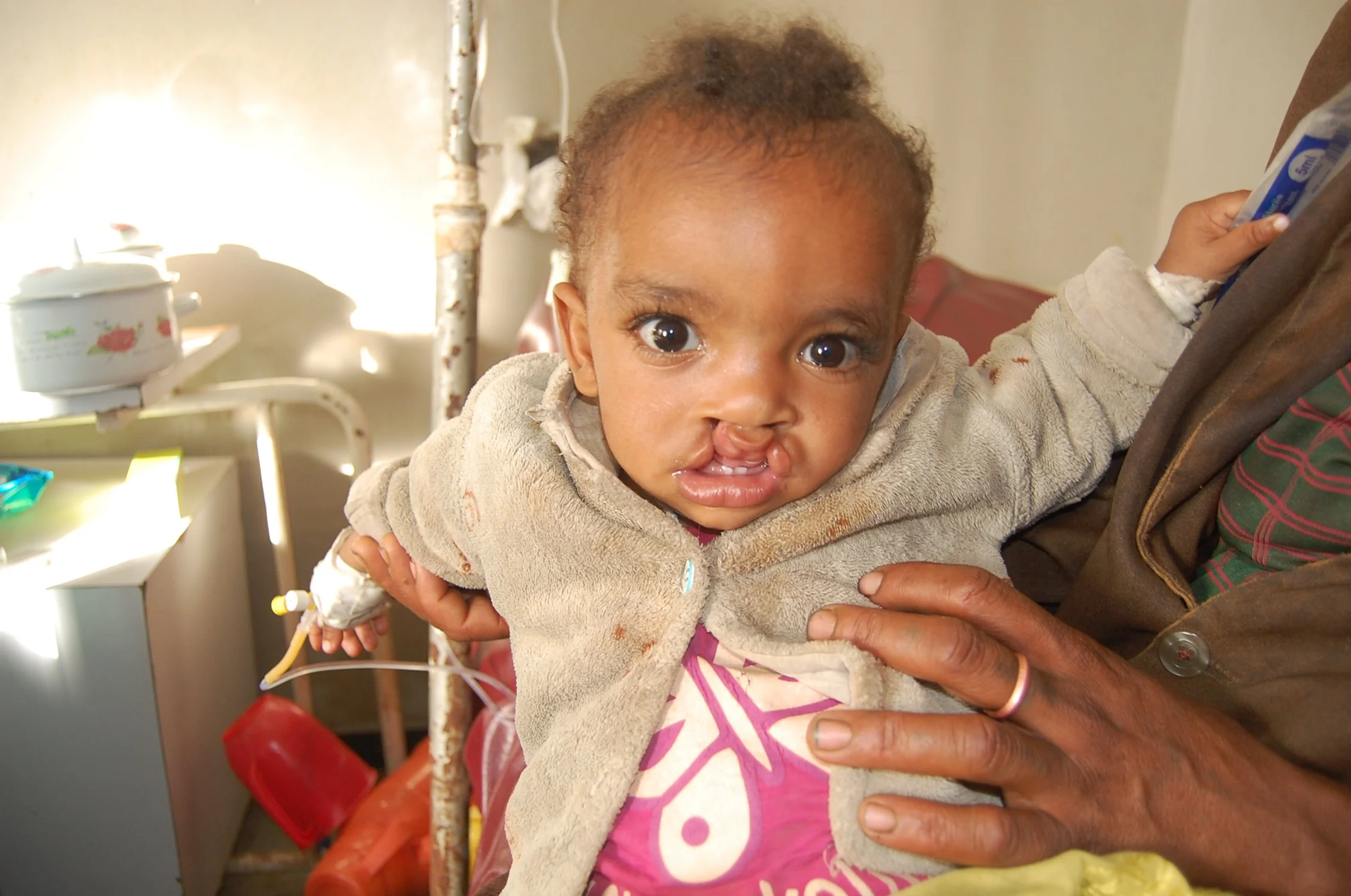 Wakjira’s Cleft Journey