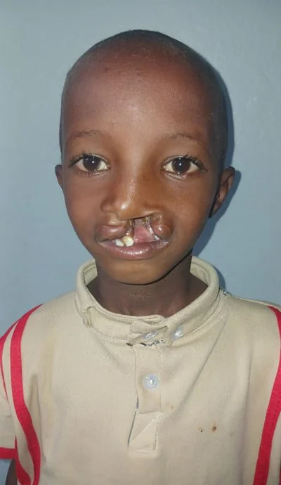 Dawud Muhammed -Before photo-June 2026-Somalie region.jpg