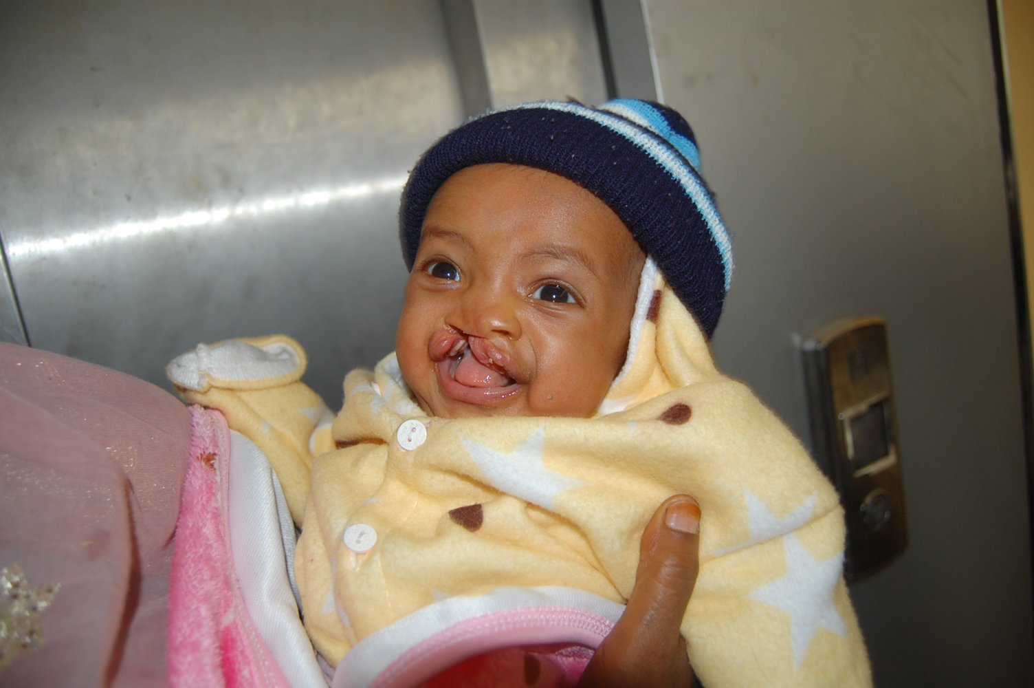 May-2026-Selam-Hospital-Teslima-Sayid-before-surgery.JPG