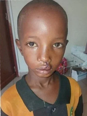 Dawud+Muhammed+-After+photo+-June+2026-Somalie+region.jpg