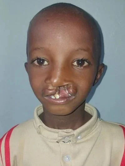 Dawud+Muhammed+-Before+photo-June+2026-Somalie+region.jpg