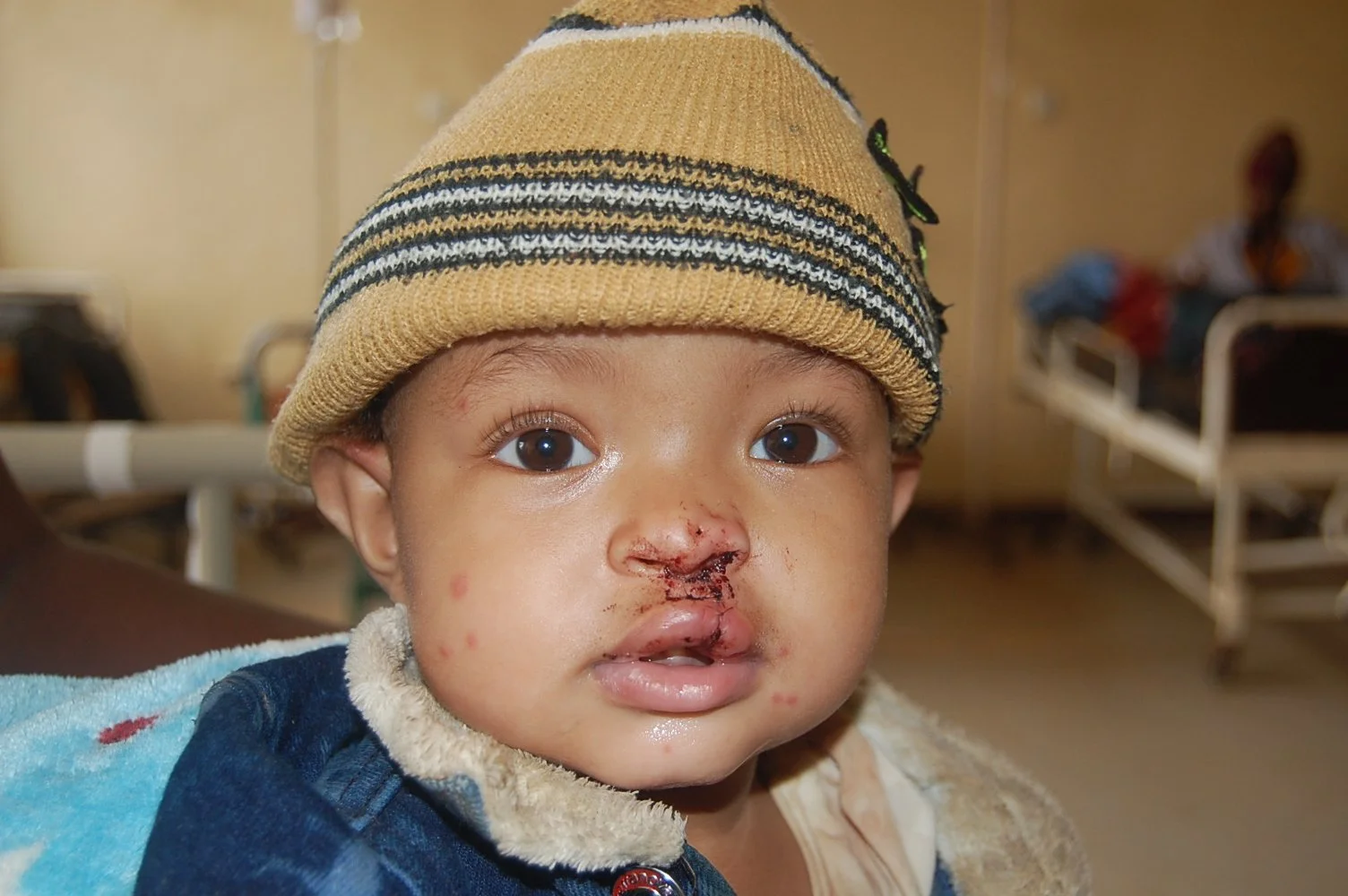 August-2026-Wolega-University-Comprehensive-Specialized-Hospital-Betelehem-Lama-After-photo.JPG