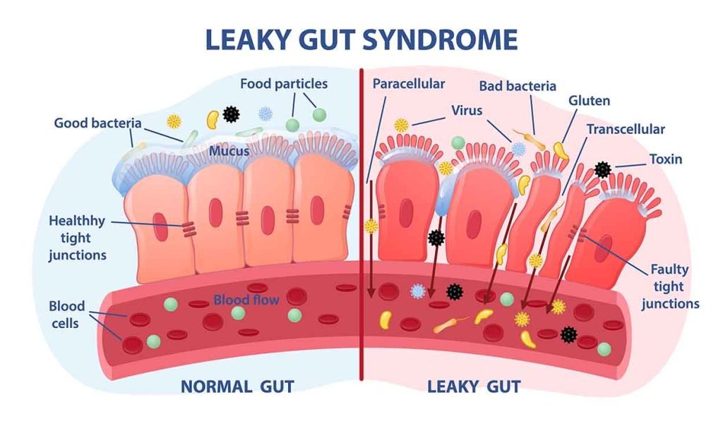 Healthy Digestion &amp; Your Brain - Don’t Forget It!