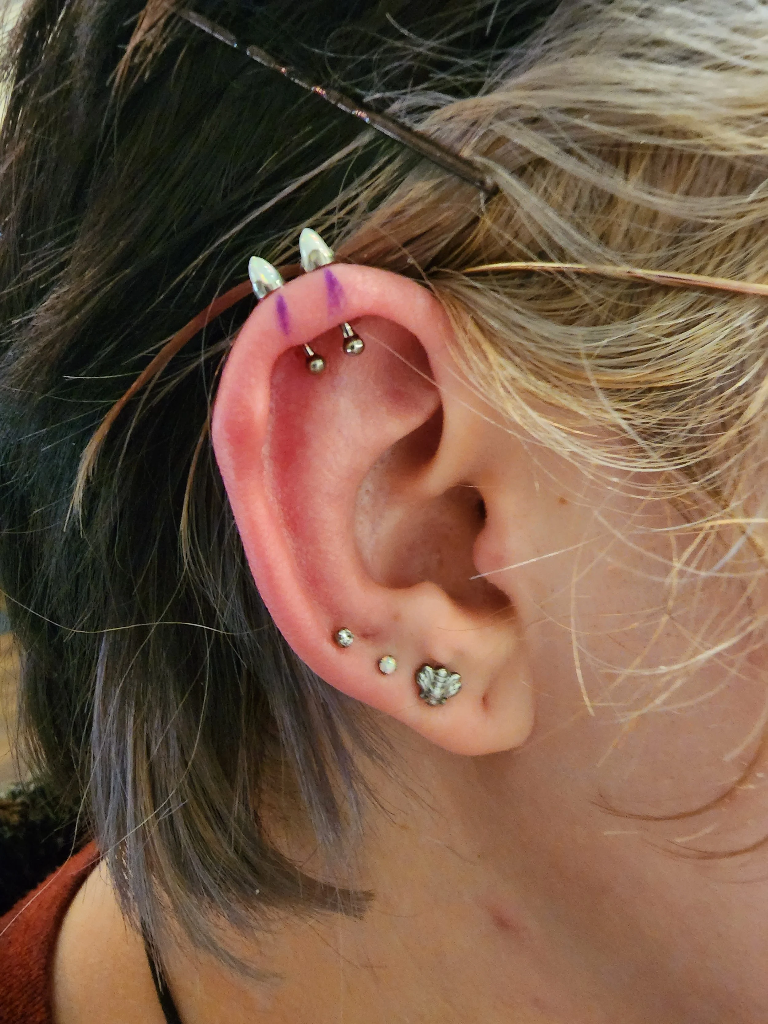 doubleverticalcartilage.jpg