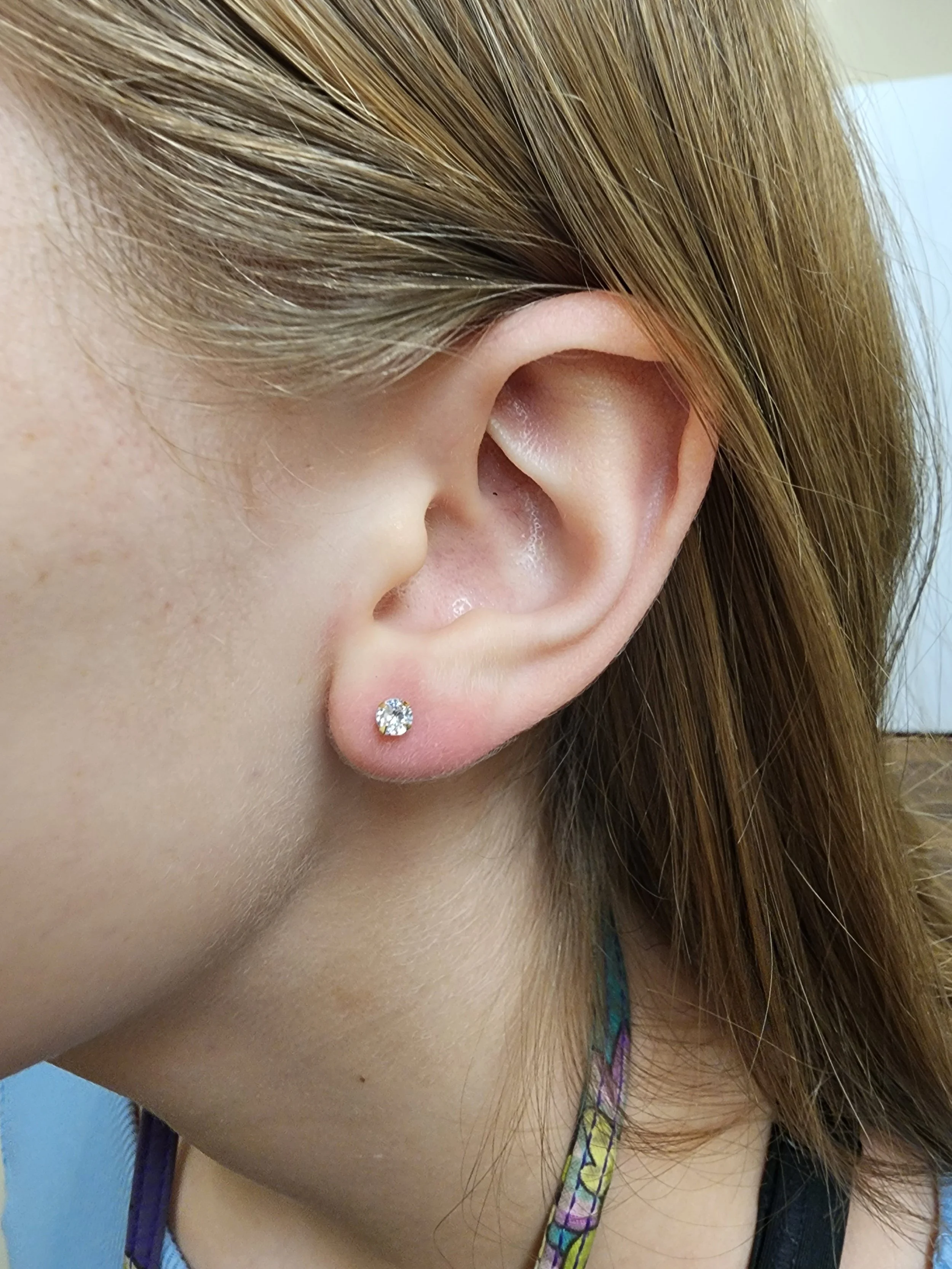 leftlobe2.jpg