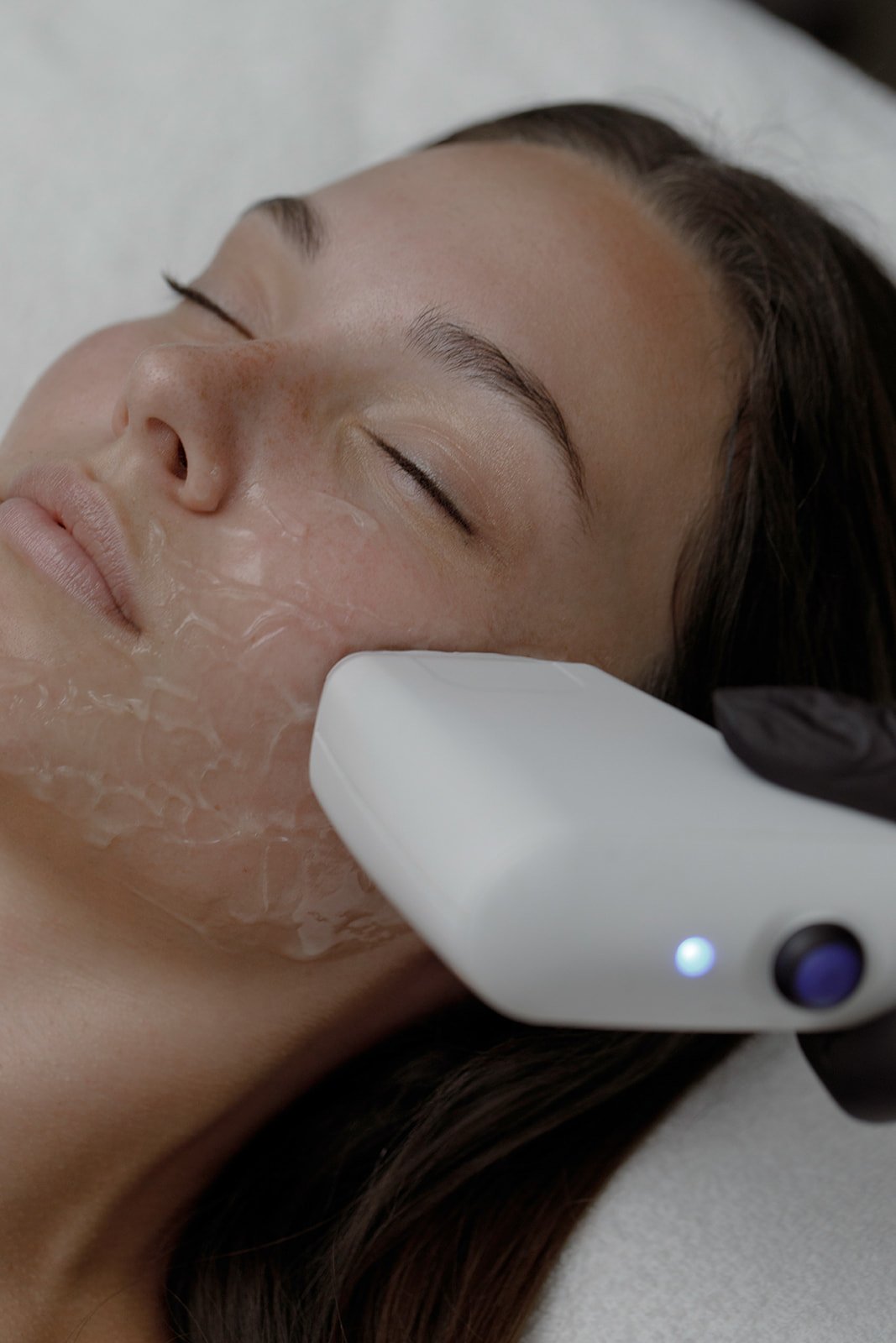 The Comstock Lasers Skincare Services Treatments