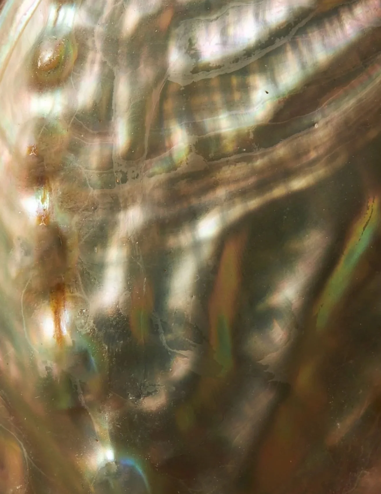 Support Your Immune System