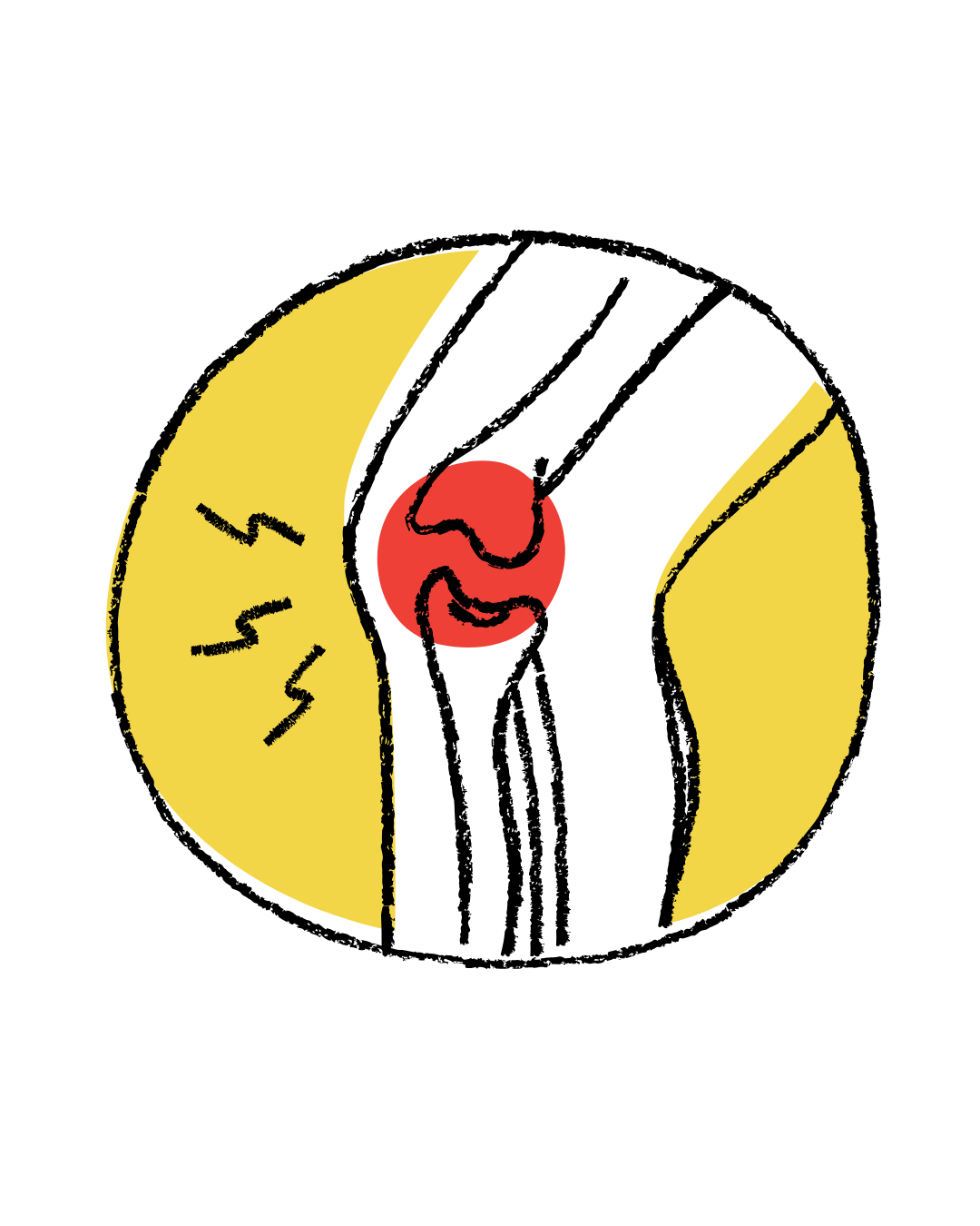 joint pain from inflamed intestines, Crohn's, colitis, ulcerative colitis, how to heal naturally