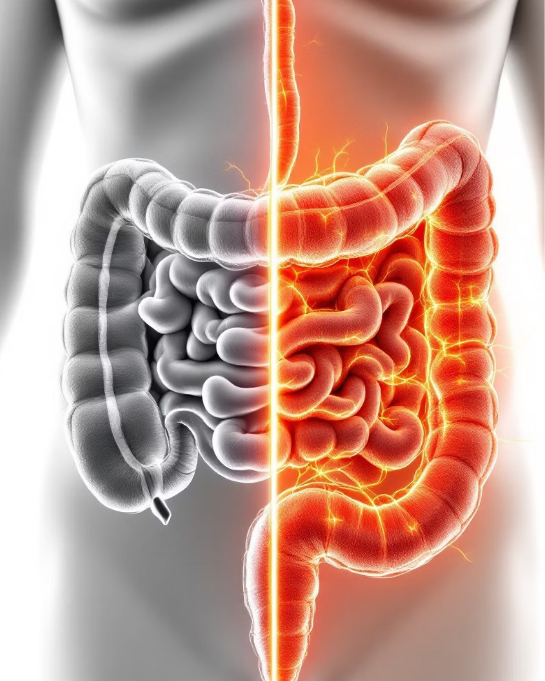 inflamed intestines, Crohn's, colitis, ulcerative colitis, how to heal naturally