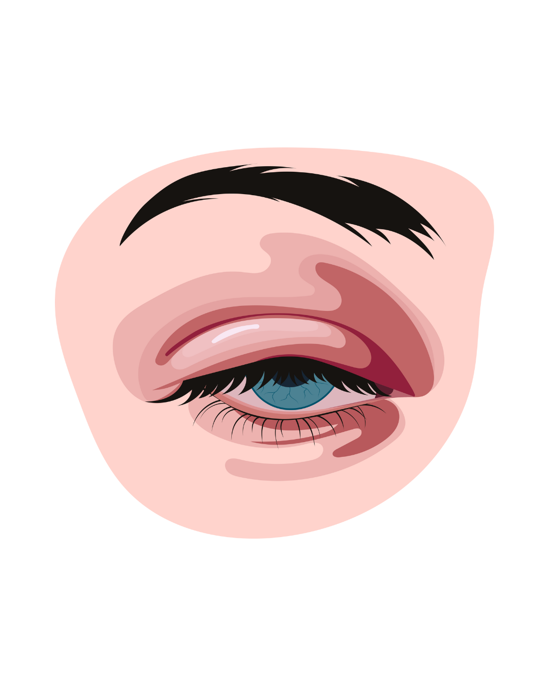 human eye inflammation from gut health, bowel disease; inflamed intestines, Crohn's, colitis, ulcerative colitis, how to heal naturally