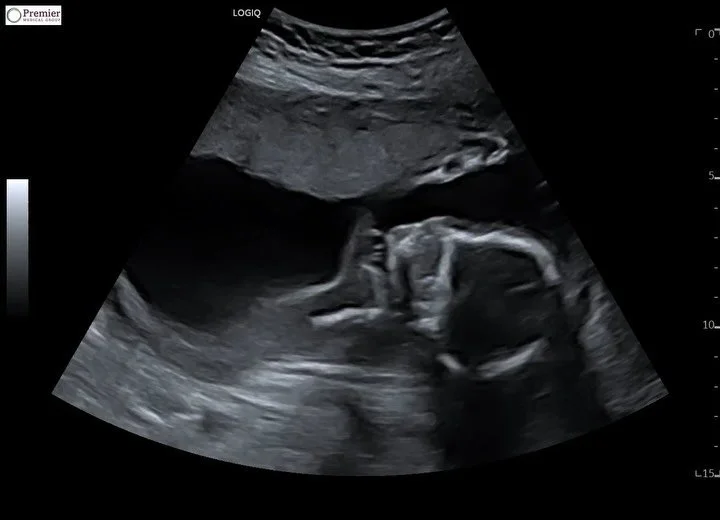 Just some randoms baby just shy of 5 months. Getting ready for the weekend!!!!