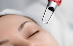 The Gold Standard in Skin Transformation: Why We Trust the Helios III