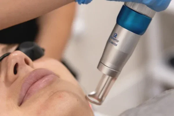Deep Thermal Lifting. Utilizing 1064nm laser technology to gently heat the dermis, stimulating massive collagen production for naturally firmer, youthful skin.