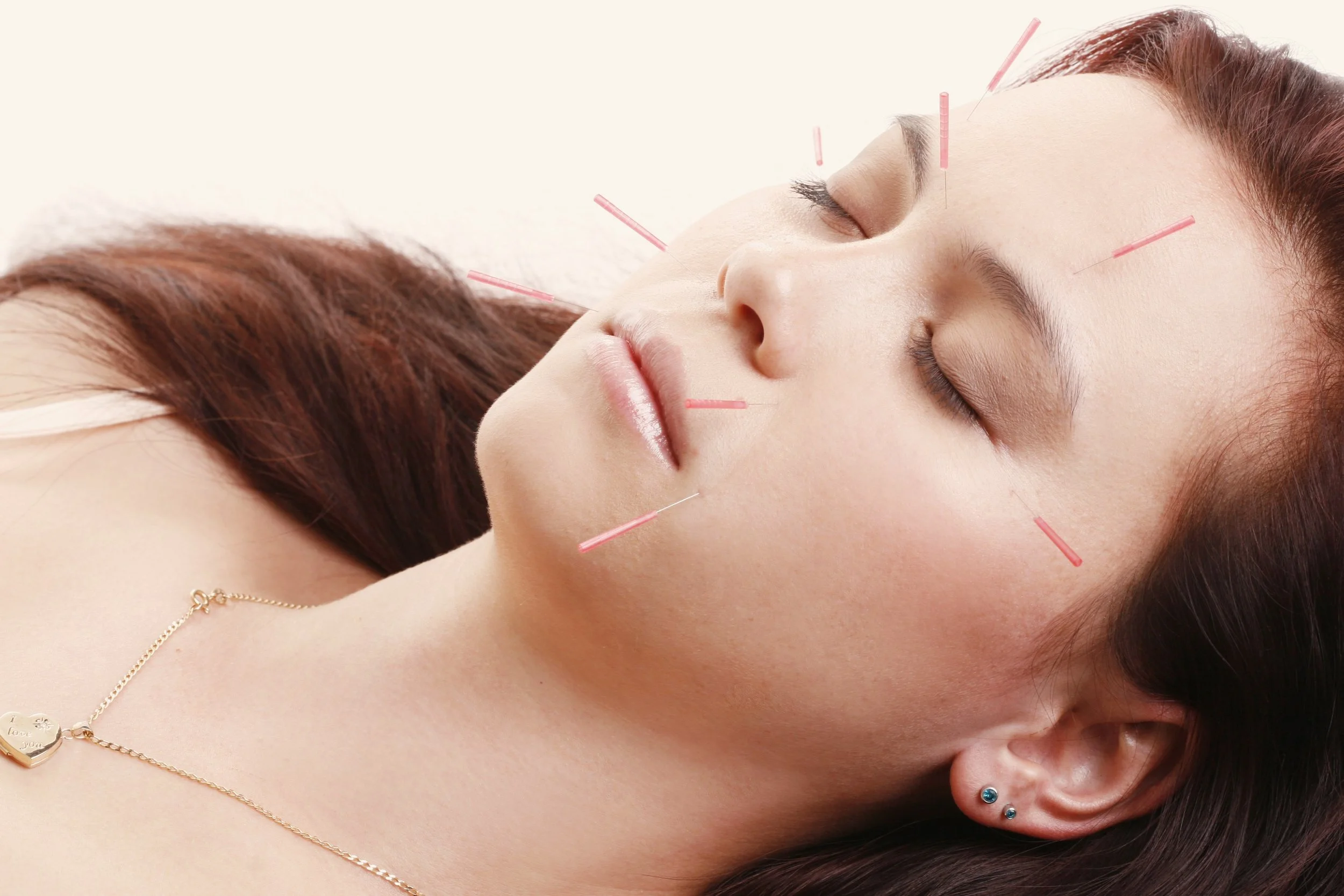 Relaxed woman with eyes closed having a Gentle Facial Acupuncture Treatment at Acupuncture Sanctuary  in Dunsborough