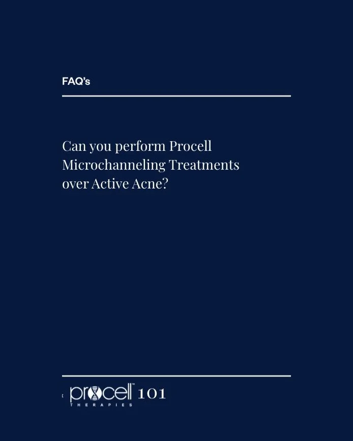 FAQ - Can Procell Microchanneling Treatments be performed over Active Acne?
Traditionally, Active Acne has been listed as a contraindication for any skin penetration treatment, including Microchanneling, due to concerns about spreading bacteria or w