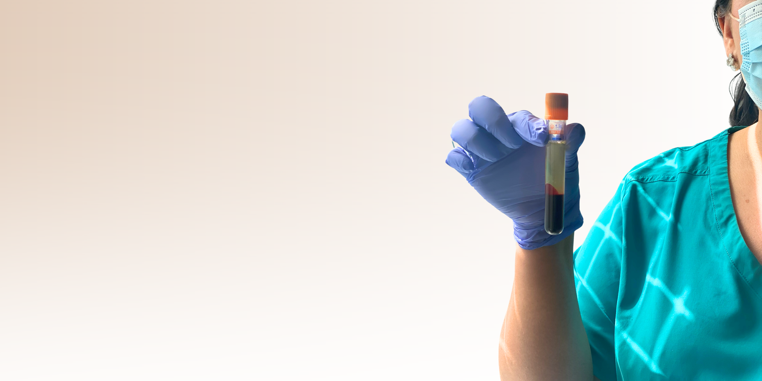 PRP Platelet rich Plasma Vermilion Cosmetic Clinic Prp platelet rich plasma vermilion cosmetic clinic