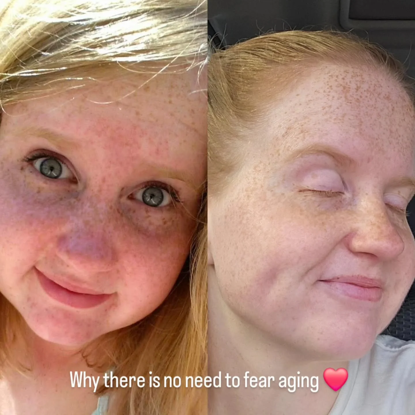 18 👉 28
What changed? Everything ❤️
(Starting with throwing away every black mascara in my cabinet)
Back then I did the best I could to help my skin 👉 I asked Google what to do.
Which lead me straight to CeraVe cleanser and SPF 🤷🏼‍♀️
But h