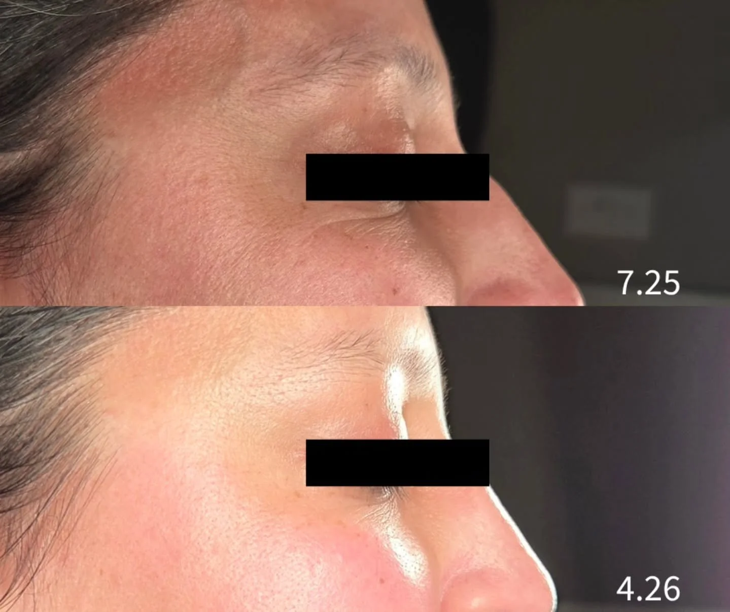 What if this was your skin transformation in less than a year?

You are stuck in this loop 👇

- Trying to figure it out on your own
- Constantly switching products 
- Hoping something finally works

It feels really frustrating.

This is what happens