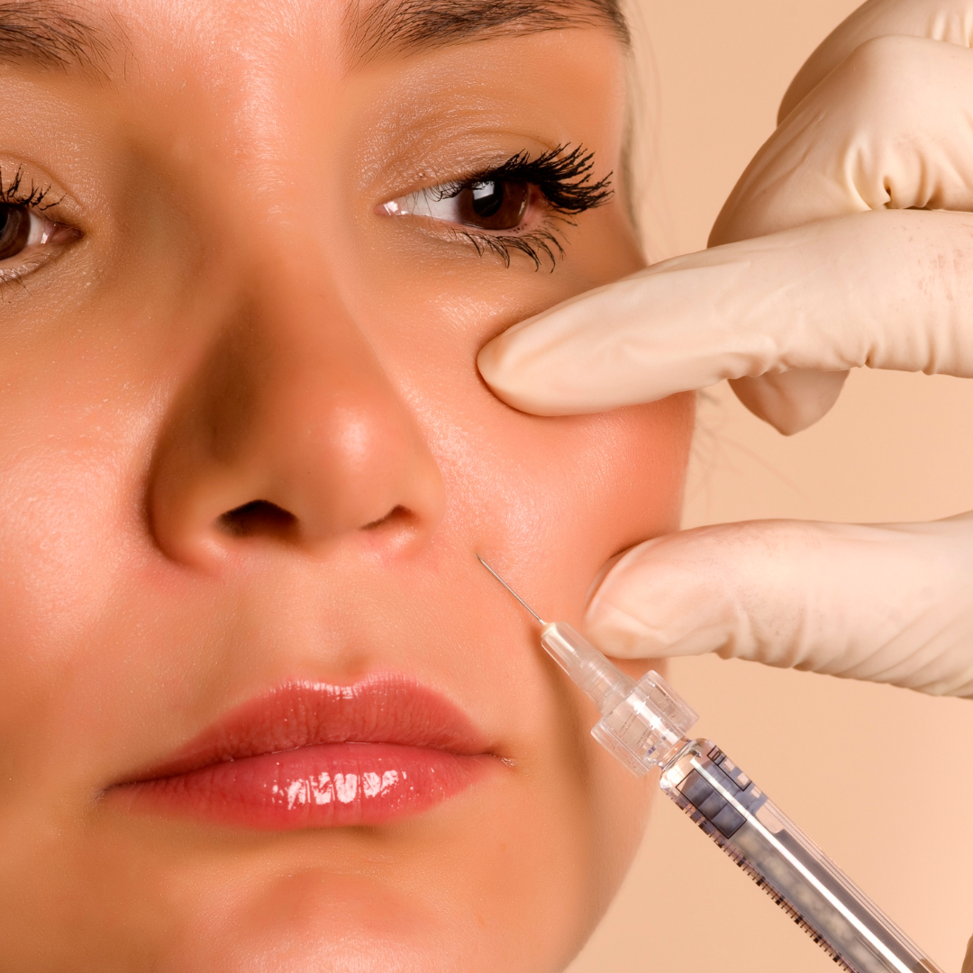 Radiesse facial injection treatment being performed at Rain Aesthetics in Glendale, AZ.